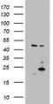 Mitochondrial Ribosomal Protein S11 antibody, LS-C789687, Lifespan Biosciences, Western Blot image 
