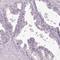 Chromosome 1 Open Reading Frame 56 antibody, HPA037429, Atlas Antibodies, Immunohistochemistry frozen image 