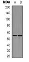 RUNX Family Transcription Factor 2 antibody, orb339212, Biorbyt, Western Blot image 