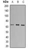 PR domain zinc finger protein 14 antibody, orb340932, Biorbyt, Western Blot image 