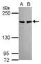 Bloom syndrome protein antibody, PA5-77880, Invitrogen Antibodies, Western Blot image 