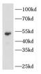 Keratin 14 antibody, FNab02195, FineTest, Western Blot image 