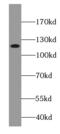 Protein cTAGE-2 antibody, FNab02043, FineTest, Western Blot image 