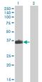 Zinc Finger And SCAN Domain Containing 26 antibody, H00007741-M04, Novus Biologicals, Western Blot image 