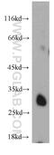 Mitochondrial dicarboxylate carrier antibody, 12086-1-AP, Proteintech Group, Western Blot image 