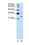 Defective In Cullin Neddylation 1 Domain Containing 1 antibody, NBP1-56537, Novus Biologicals, Western Blot image 