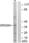 Olfactory Receptor Family 52 Subfamily N Member 1 antibody, A18786, Boster Biological Technology, Western Blot image 