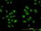 A-Kinase Anchoring Protein 13 antibody, H00011214-M01, Novus Biologicals, Immunofluorescence image 