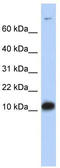 Fatty Acid Binding Protein 3 antibody, TA342388, Origene, Western Blot image 