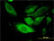 EARP Complex And GARP Complex Interacting Protein 1 antibody, LS-C198375, Lifespan Biosciences, Immunofluorescence image 