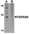 Tetraspanin 9 antibody, NBP1-77098, Novus Biologicals, Western Blot image 