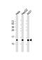 NADH:Ubiquinone Oxidoreductase Subunit B3 antibody, M12461, Boster Biological Technology, Western Blot image 