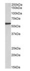 Epoxide Hydrolase 2 antibody, orb308872, Biorbyt, Western Blot image 