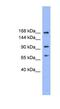 ADAM Metallopeptidase With Thrombospondin Type 1 Motif 19 antibody, NBP1-69170, Novus Biologicals, Western Blot image 