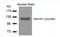 Glutamate Ionotropic Receptor NMDA Type Subunit 1 antibody, NB100-82092, Novus Biologicals, Western Blot image 