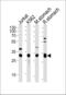 Esterase D antibody, 61-014, ProSci, Western Blot image 