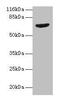 G Protein-Coupled Receptor Kinase 4 antibody, CSB-PA009925LA01HU, Cusabio, Western Blot image 
