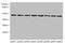 Serpin B3 antibody, A55751-100, Epigentek, Western Blot image 