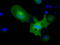 Pyruvate Kinase L/R antibody, TA501472, Origene, Immunofluorescence image 