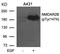 Glutamate Ionotropic Receptor NMDA Type Subunit 2B antibody, GTX50221, GeneTex, Western Blot image 