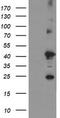 Transmembrane Protein 173 antibody, TA505017BM, Origene, Western Blot image 