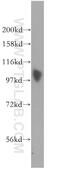 Nuclear autoantigen Sp-100 antibody, 11377-1-AP, Proteintech Group, Western Blot image 