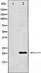 Survivin antibody, orb99400, Biorbyt, Western Blot image 