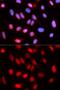 Replication Factor C Subunit 4 antibody, GTX33465, GeneTex, Immunofluorescence image 