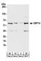 Ubiquitin Specific Peptidase 14 antibody, A300-919A, Bethyl Labs, Western Blot image 