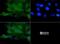 Transient Receptor Potential Cation Channel Subfamily V Member 1 antibody, NBP1-71774, Novus Biologicals, Immunocytochemistry image 