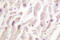 Dematin Actin Binding Protein antibody, LS-C176504, Lifespan Biosciences, Immunohistochemistry frozen image 