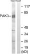 Serine/threonine-protein kinase PAK 3 antibody, LS-C118319, Lifespan Biosciences, Western Blot image 