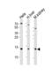 Cytidine Deaminase antibody, 61-565, ProSci, Western Blot image 