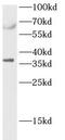 Caspase 7 antibody, FNab10124, FineTest, Western Blot image 