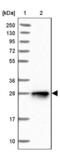 Nudix Hydrolase 8 antibody, NBP1-81908, Novus Biologicals, Western Blot image 