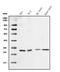 Stratifin antibody, PA1797, Boster Biological Technology, Western Blot image 