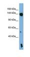 NLR Family Pyrin Domain Containing 1 antibody, orb325922, Biorbyt, Western Blot image 
