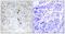 Basic Leucine Zipper ATF-Like Transcription Factor antibody, TA315071, Origene, Immunohistochemistry paraffin image 