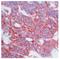 Epithelial Cell Adhesion Molecule antibody, DM406, Origene, Immunohistochemistry frozen image 