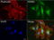 Porphobilinogen deaminase antibody, LS-C796862, Lifespan Biosciences, Immunofluorescence image 