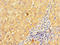 Inv antibody, LS-C678365, Lifespan Biosciences, Immunohistochemistry paraffin image 