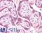 KRAS Proto-Oncogene, GTPase antibody, LS-B4683, Lifespan Biosciences, Immunohistochemistry paraffin image 