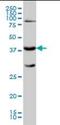 Galactose-1-Phosphate Uridylyltransferase antibody, orb94649, Biorbyt, Western Blot image 