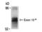 Bridging Integrator 1 antibody, M01551-2, Boster Biological Technology, Immunoprecipitation image 
