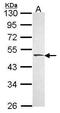 Hyaluronidase 1 antibody, PA5-29816, Invitrogen Antibodies, Western Blot image 