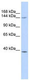 Structural maintenance of chromosomes protein 4 antibody, TA339284, Origene, Western Blot image 