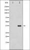 Uncoupling Protein 2 antibody, orb337422, Biorbyt, Western Blot image 