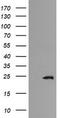 RAB21, Member RAS Oncogene Family antibody, CF505738, Origene, Western Blot image 