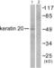 Keratin 20 antibody, abx013124, Abbexa, Western Blot image 
