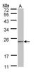 NADH:Ubiquinone Oxidoreductase Complex Assembly Factor 4 antibody, TA309008, Origene, Western Blot image 